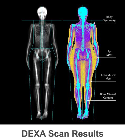 spine thickness test|DXA Scan (Bone Density Test): What Is It & How It's .